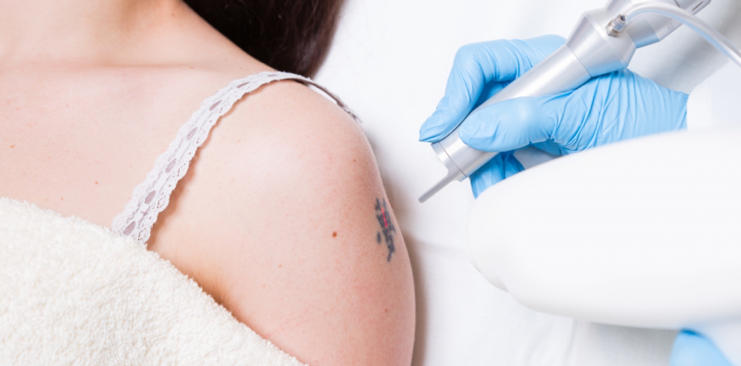 what can you expect with tattoo removal procedures art of what can you expect with tattoo removal procedures art of