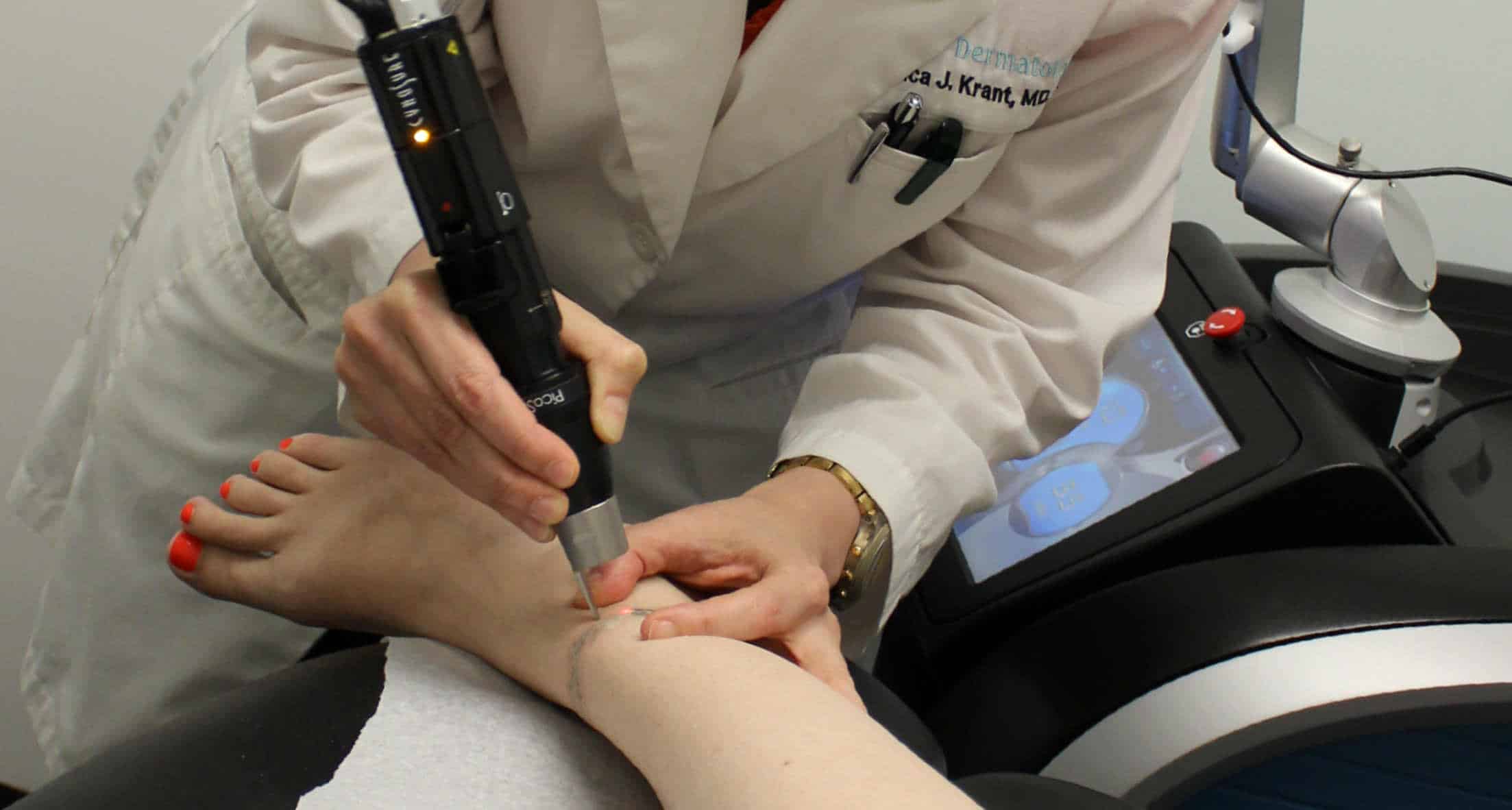 Dr. Jessica Krant tattoo removal