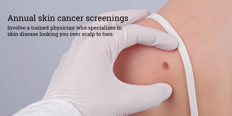 Annual-skin-cancer-screenings