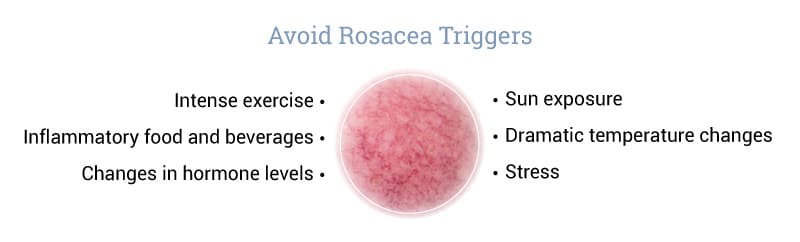 Avoid-Rosacea-Triggers