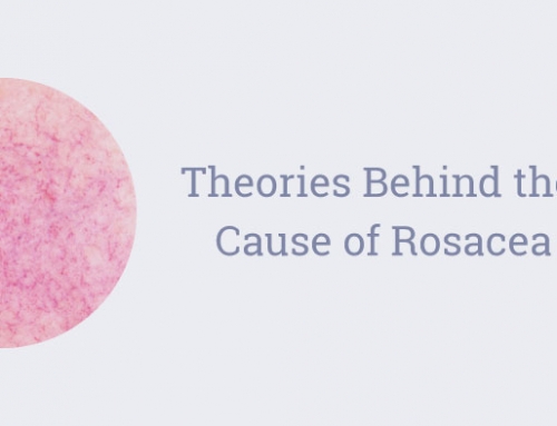 Theories Behind the Cause of Rosacea