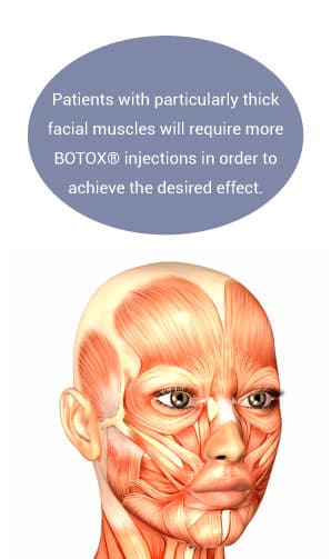 thick-facial-muscles