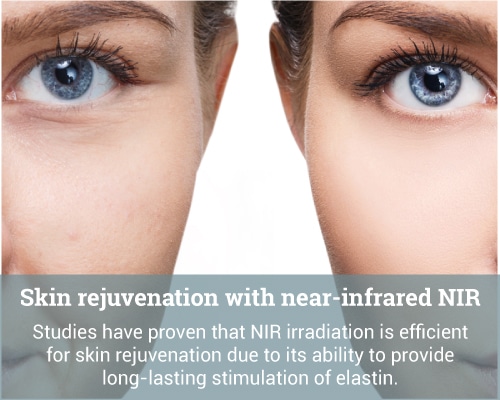 Skin-rejuvenation-with-near-infrared-NIR