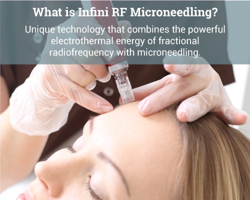 What-is-Infini-RF-Microneedling-