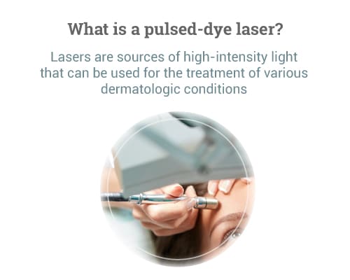 What-is-a-pulsed-dye-laser-