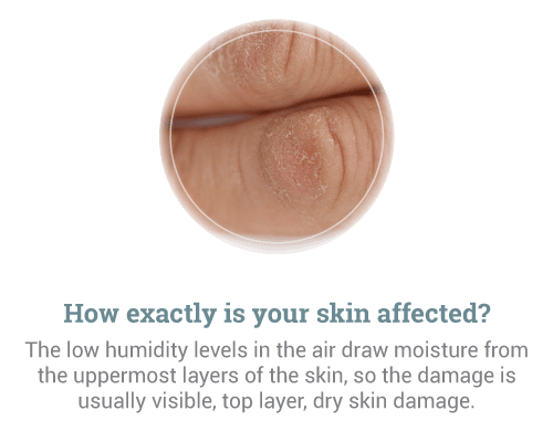 How-exactly-is-your-skin-affected-