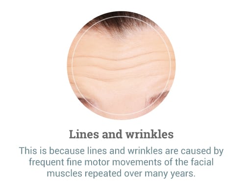 Lines-and-wrinkles