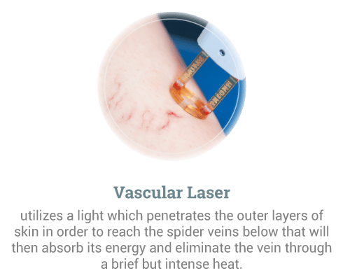 Vascular-Laser