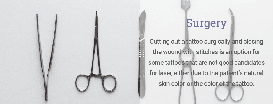 Cutting out a tattoo surgically and closing the wound with stitches is an option for some tattoos that are not good candidates for laser, either due to the patient’s natural skin color, or the color of the tattoo.