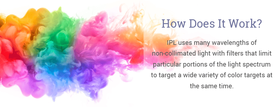 IPL uses many wavelengths of non-collimated light with filters that limit particular portions of the light spectrum to target a wide variety of color targets at the same time.