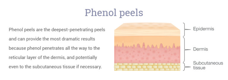 Find Your Perfect Facial Peel The 3 Main Types Art of