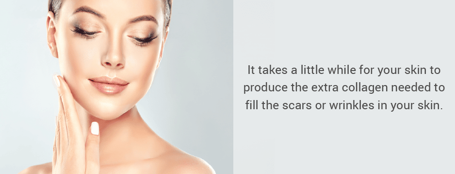 It takes a little while for your skin to produce the extra collagen needed to tighten and smooth the scars or wrinkles in your skin.