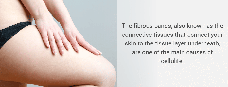 The fibrous bands, also known as the connective tissues that connect your skin to the tissue layer underneath, are one of the main causes.