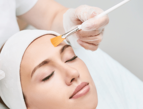 Do Dermatologists Recommend Chemical Peels?