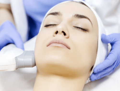 Your Cosmetic Laser Options Explained