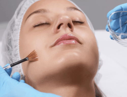 Which Chemical Peel Is Right for You?