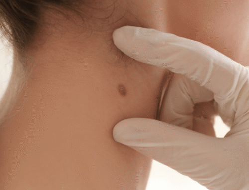 Your Annual Skin Cancer Screening: Why NYC Dermatologists Recommend It Every Year