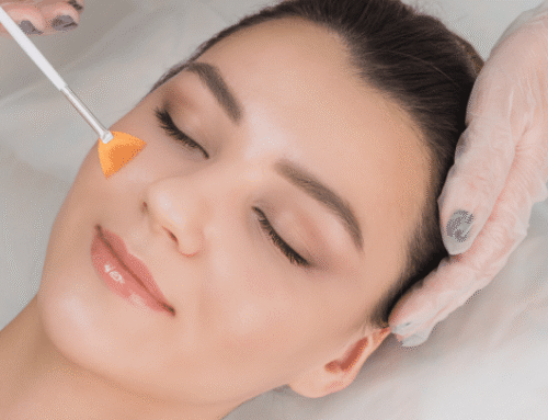 Complete Guide to Chemical Peels: Understanding Safety & Seasonal Considerations